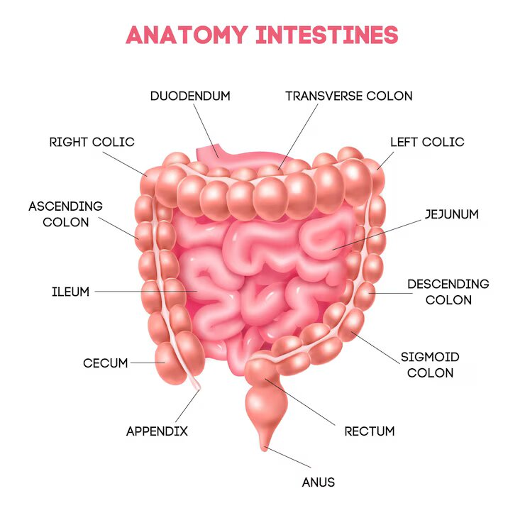 Colectomy